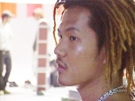 整形疑惑